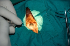 cme-innovaions-in-phaco-and-sics-with-live-surgery-demo-47